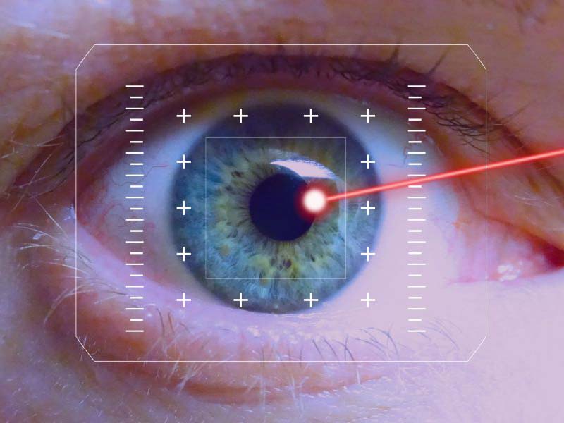 Você está visualizando atualmente Cirurgia Refrativa – PRK, LASIK e SMILE – Tecnologia para diminuir a dependência dos óculos
