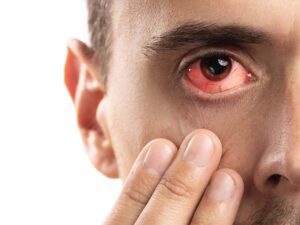 Leia mais sobre o artigo Olhos Alérgicos: Causas, Cuidados e Como Lidar