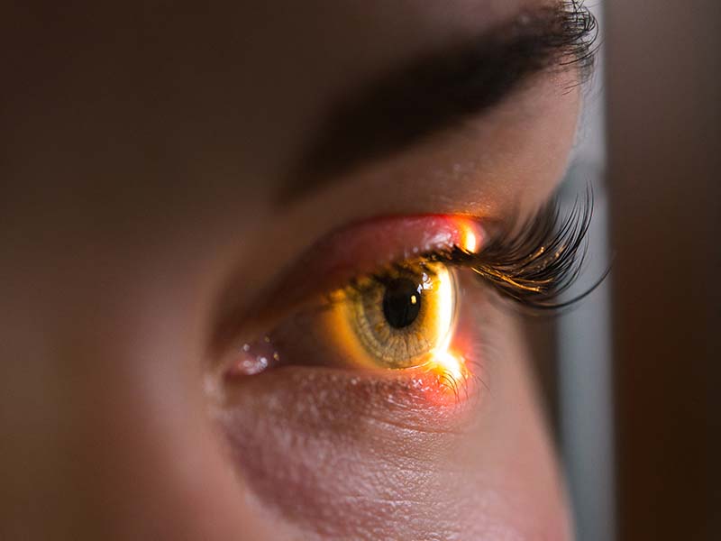 Você está visualizando atualmente Meus remédios podem influenciar no glaucoma?