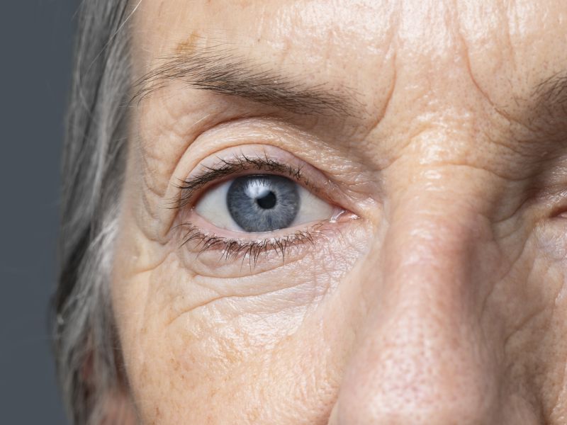 No momento, você está visualizando Abril Marrom: A Importância da Prevenção Contra a Cegueira