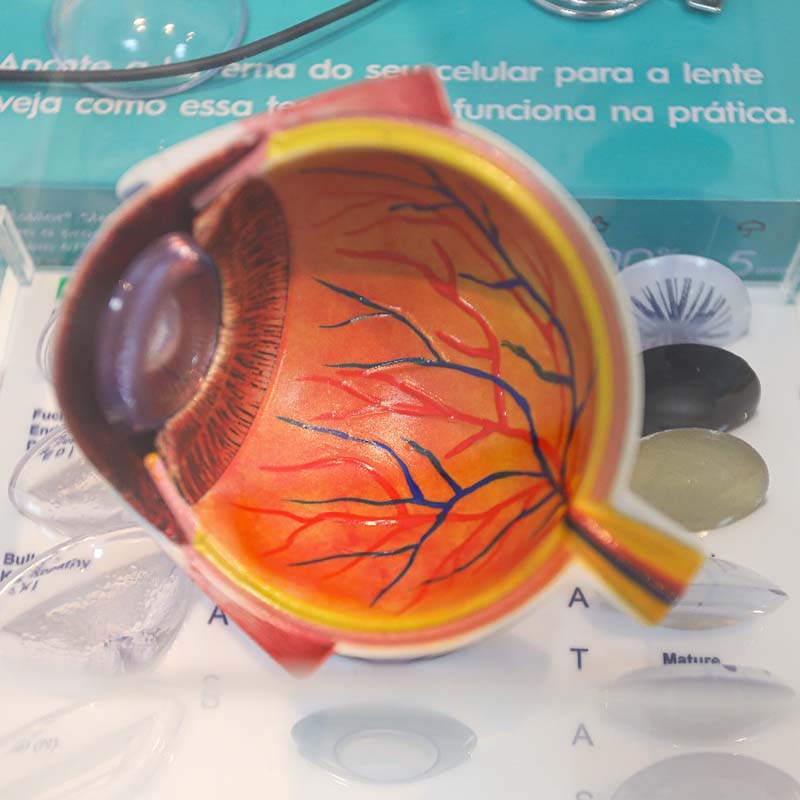 prisma visao oftalmologia a clinica 03 25
