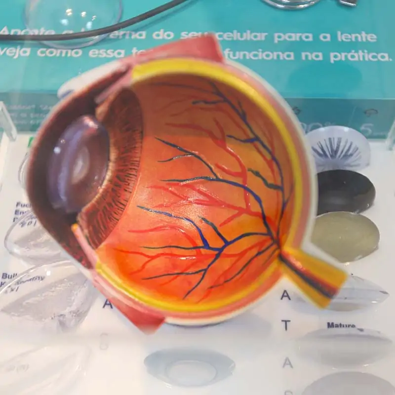 prisma visao oftalmologia a clinica 03 25
